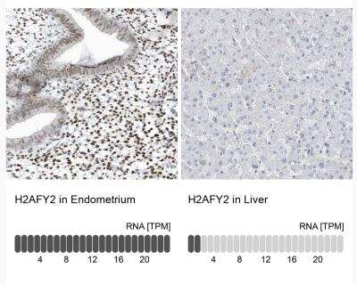 Immunohistochemistry-Paraffin: Macro H2A.2 Antibody [NBP1-92094]