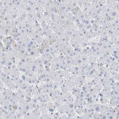 Immunohistochemistry-Paraffin: Macro H2A.2 Antibody [NBP1-92094]