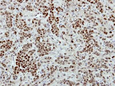 Immunohistochemistry-Paraffin: Macro H2A.2 Antibody [NBP2-17197]