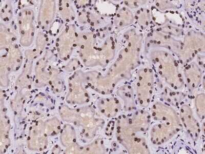 Immunohistochemistry-Paraffin: Macro H2A.2 Antibody [NBP2-97224]