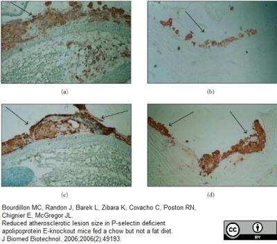 Immunohistochemistry: Macrophage Antibody (MOMA-2) - BSA Free [NB100-64946]