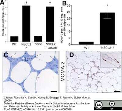 Immunohistochemistry: Macrophage Antibody (MOMA-2) - BSA Free [NB100-64946]