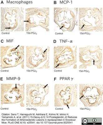 Immunohistochemistry: Macrophage Antibody (MOMA-2) - BSA Free [NB100-64946]