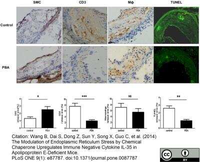 Immunohistochemistry: Macrophage Antibody (MOMA-2) - BSA Free [NB100-64946]