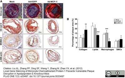 Immunohistochemistry: Macrophage Antibody (MOMA-2) - BSA Free [NB100-64946]
