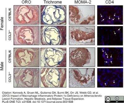 Immunohistochemistry: Macrophage Antibody (MOMA-2) - BSA Free [NB100-64946]
