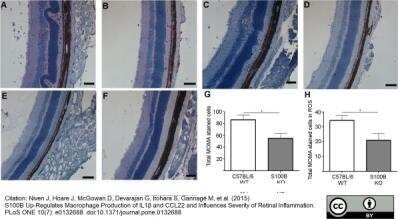 Immunohistochemistry: Macrophage Antibody (MOMA-2) - BSA Free [NB100-64946]