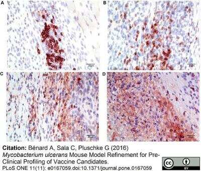 Immunohistochemistry: Macrophage Antibody (MOMA-2) - BSA Free [NB100-64946]
