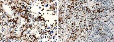 Immunohistochemistry-Paraffin: Macrophage Antibody (RM0029-11H3) - Azide and BSA Free [NBP2-12436]