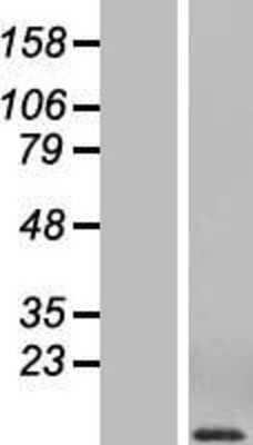 Western Blot: CCL3/MIP-1 alpha Overexpression Lysate [NBL1-08856]