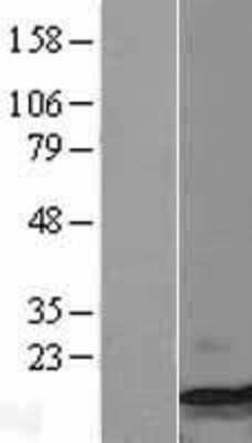 Western Blot: CCL4/MIP-1 beta Overexpression Lysate [NBL1-08858]