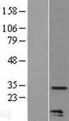 Western Blot: CCL20/MIP-3 alpha Overexpression Lysate [NBL1-08850]