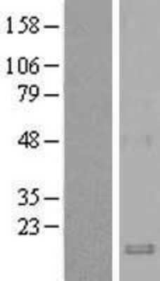 Western Blot: CCL19/MIP-3 beta Overexpression Lysate [NBL1-08848]