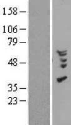 Western Blot: CCL18/PARC Overexpression Lysate [NBP2-10864]