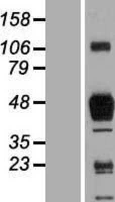 Western Blot: SR-AI/MSR Overexpression Lysate [NBP2-05633]