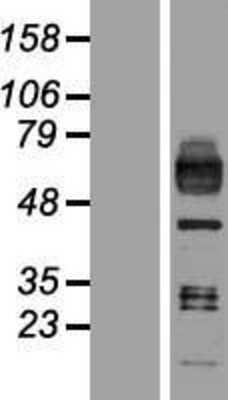 Western Blot: SR-AI/MSR Overexpression Lysate [NBP2-10831]