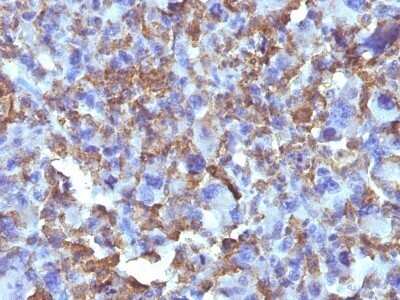 Immunohistochemistry-Paraffin: Macrophage and Histiocytoma Marker Antibody (D11) - IHC-Prediluted [NBP2-48138]