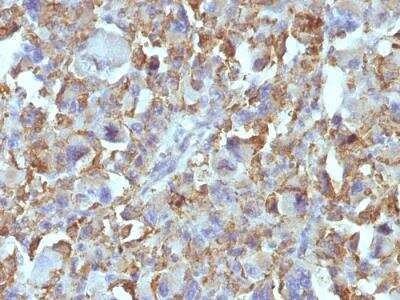Immunohistochemistry-Paraffin: Macrophage and Histiocytoma Marker Antibody (D11) - IHC-Prediluted [NBP2-48138]