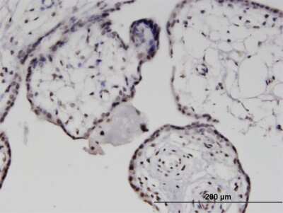 Immunohistochemistry-Paraffin: Mad Antibody (2G10) [H00004084-M03]