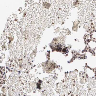 Immunohistochemistry-Paraffin: Mad Antibody [NBP1-89979]