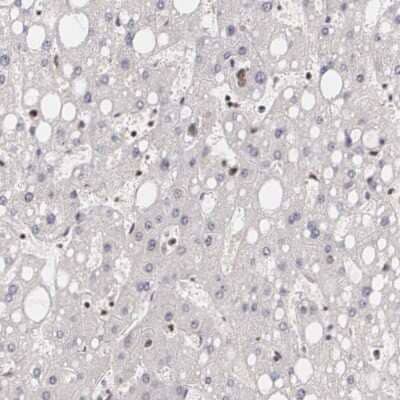 Immunohistochemistry-Paraffin: Mad Antibody [NBP1-89979]