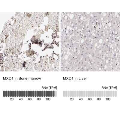 Immunohistochemistry-Paraffin: Mad Antibody [NBP1-89979]