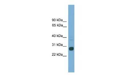 Western Blot: Mad Antibody [NBP3-10418]