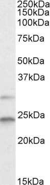 Western Blot: MAD2L1 Antibody [NB300-880]