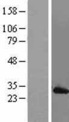 Western Blot: MAD2L1 Overexpression Lysate [NBL1-12786]