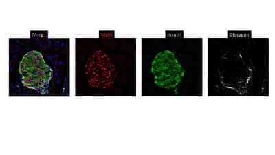 Immunocytochemistry/ Immunofluorescence: MafA Antibody [NBP1-00121]