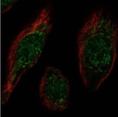 Immunocytochemistry/ Immunofluorescence: MafB Antibody [NBP1-81342]