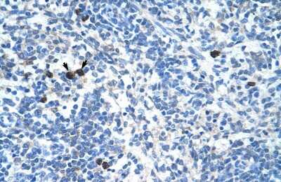 Immunohistochemistry: MafB Antibody [NBP2-87768]