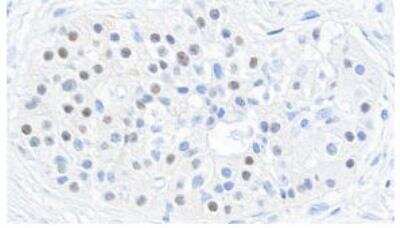 Immunohistochemistry: MafB Antibody (BLR046F) [NBP3-14673]