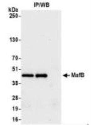 Immunoprecipitation: MafB Antibody (BLR046F) [NBP3-14673]