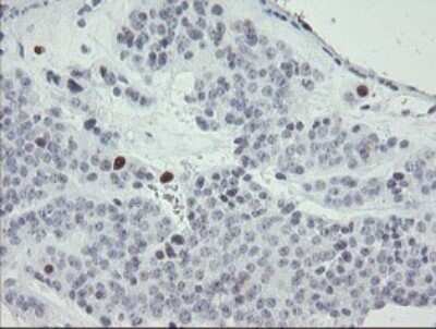 Immunohistochemistry: MafB Antibody (OTI1E9) [NBP2-45718]