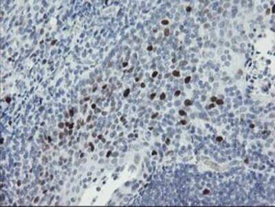 Immunohistochemistry: MafB Antibody (OTI1E9) [NBP2-45718]