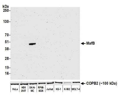 Western Blot: MafB Antibody (BLR046F) [NBP3-14673]