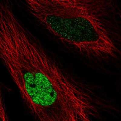 Immunocytochemistry/ Immunofluorescence: MafK Antibody [NBP2-56366]