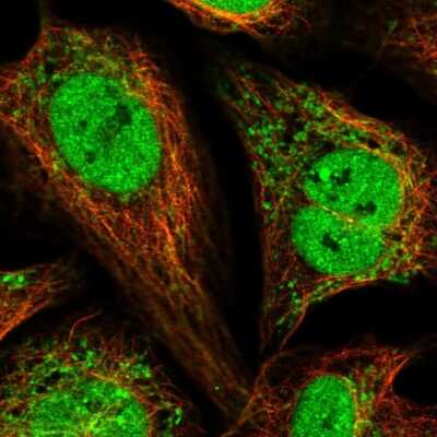 Immunocytochemistry/ Immunofluorescence: Magmas Antibody [NBP2-57408]