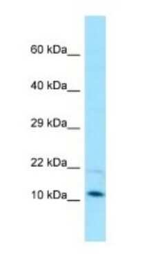 Western Blot: Magmas Antibody [NBP1-98528]