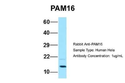 Western Blot: Magmas Antibody [NBP1-98528]
