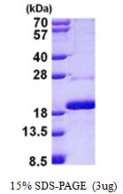 SDS-PAGE: Recombinant Human Mago nashi homolog 2 His Protein [NBP2-23209]