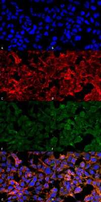 Immunocytochemistry/ Immunofluorescence: Malondialdehyde Antibody (11E3) [NBP2-59367]
