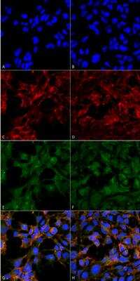 Immunocytochemistry/ Immunofluorescence: Malondialdehyde Antibody (6H6) [NBP2-59366]