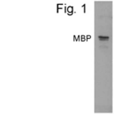 Western Blot: Maltose Binding Protein Antibody [NBP2-22462]