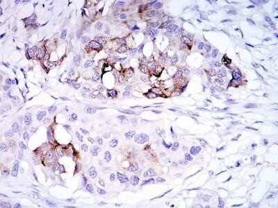 Immunohistochemistry-Paraffin: Mammaglobin A Antibody (3C8) - BSA Free [NBP1-51671]