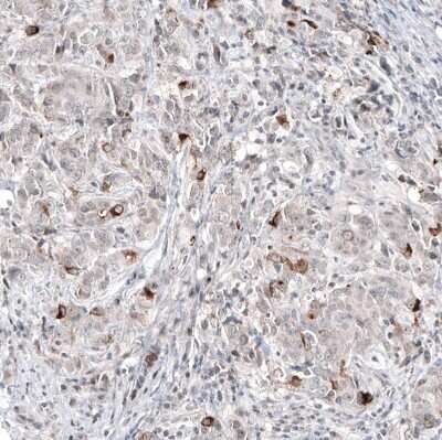 Immunohistochemistry-Paraffin: Mammaglobin A Antibody (CL8892) [NBP3-05504]