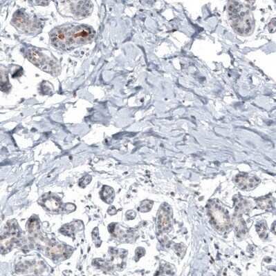 Immunohistochemistry-Paraffin: Mammaglobin A Antibody (CL8892) [NBP3-05504]