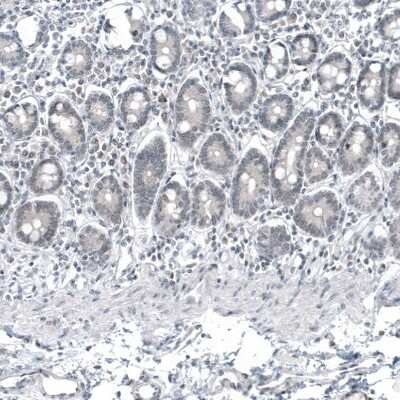 Immunohistochemistry-Paraffin: Mammaglobin A Antibody (CL8892) [NBP3-05504]