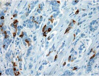 Immunohistochemistry-Paraffin: Mammaglobin A Antibody (EPR9092) [NBP2-41752]